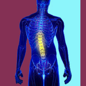 Mesenchymal Scoliosis