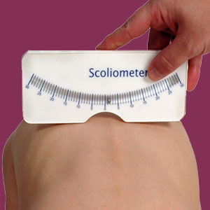 scoliometer