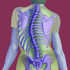 Adolescent scoliosis