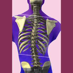 Chiropractic for Scoliosis