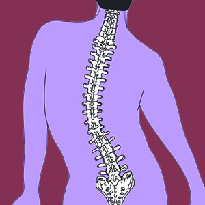 Consequences of Scoliosis