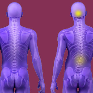 Psychosomatic Scoliosis Pain