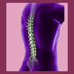 Scoliosis Hypokyphosis