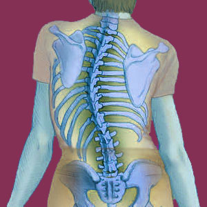 Scoliosis in the Elderly