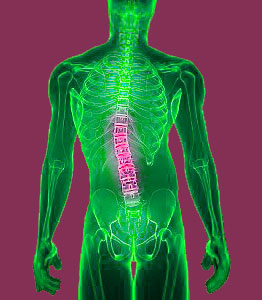 Scoliosis pain