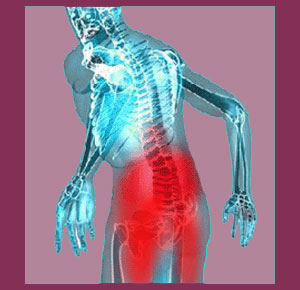 Scoliosis Pain Management