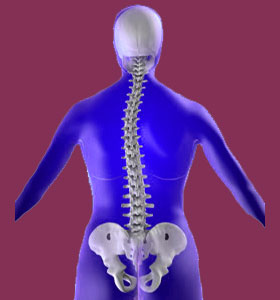 Scoliosis Products
