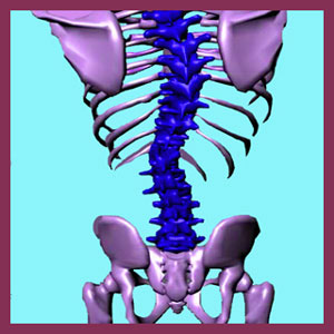 Scoliosis Symptoms