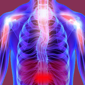 Thoracic Scoliosis